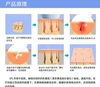 【家用激光脱毛器去毛仪光子剃毛器阴毛脸毛私处无痛永久正品批发】价格_厂家_图片 -